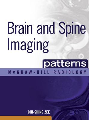 Brain and Spine Imaging Patterns: Brain & Spine Imaging