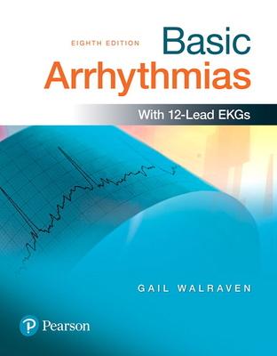 Basic Arrhythmias