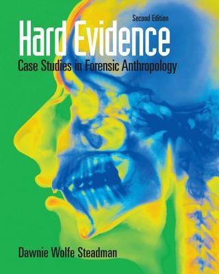 Hard Evidence: Case Studies in Forensic Anthropology