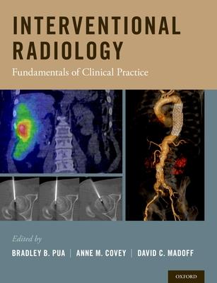 Interventional Radiology: Fundamentals of Clinical Practice