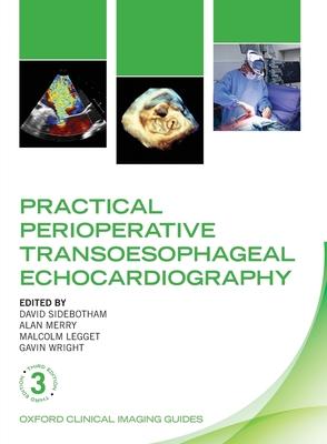 Practical Perioperative Transoesophageal Echocardiography