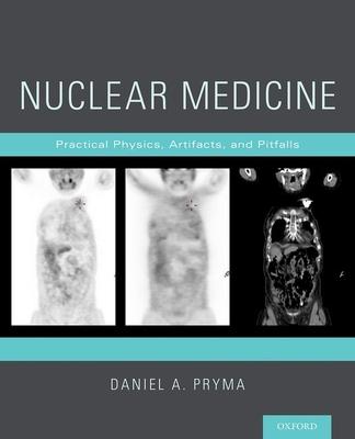 Nuclear Medicine: Practical Physics, Artifacts, and Pitfalls