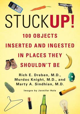 Stuck Up!: 100 Objects Inserted and Ingested in Places They Shouldn't Be