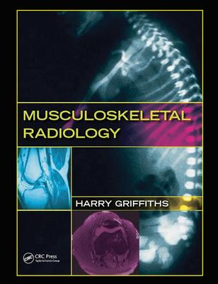 Musculoskeletal Radiology Subscription