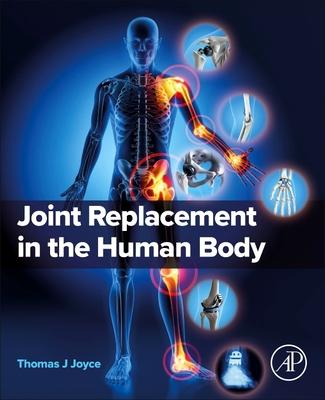 Joint Replacement in the Human Body Subscription