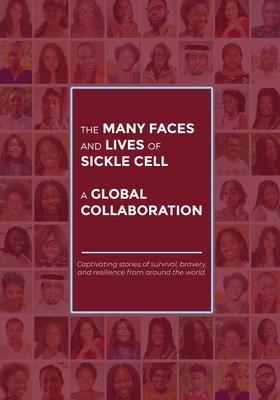 The Many Faces and Lives of Sickle Cell - A Global Collaboration