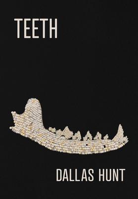 Teeth: Poems