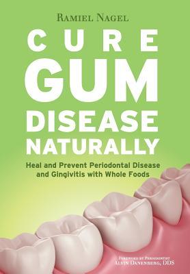 Cure Gum Disease Naturally: Heal Gingivitis and Periodontal Disease with Whole Foods