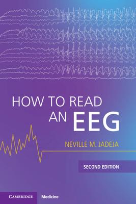 How to Read an Eeg Subscription