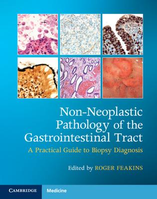 Non-Neoplastic Pathology of the Gastrointestinal Tract with Online Resource: A Practical Guide to Biopsy Diagnosis [With Access Code]