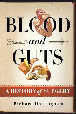 Blood and Guts: A History of Surgery