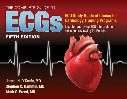 The Complete Guide to Ecgs: A Comprehensive Study Guide to Improve ECG Interpretation Skills: A Comprehensive Study Guide to Improve ECG Interpretatio