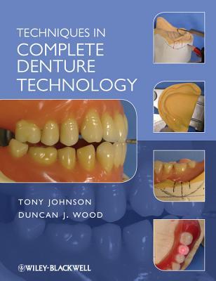 Techniques in Complete Denture