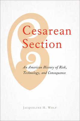 Cesarean Section: An American History of Risk, Technology, and Consequence