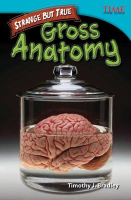 Strange But True: Gross Anatomy: Gross Anatomy