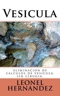 Vesicula: eliminacion de calculos de vesicula, sin cirugia.