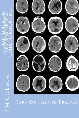 CT Head: DIAGNOSIS A Radiographers Guide To Reporting Part 1 Acute Trauma: Part One Acute Trauma