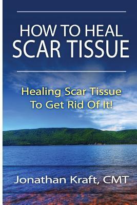 How to Heal Scar Tissue: How to Heal Your Own Scar Tissue And Get Rid Of It!