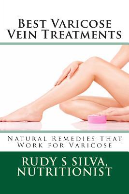 Best Varicose Vein Treatments: Natural Remedies That Work For Varicose