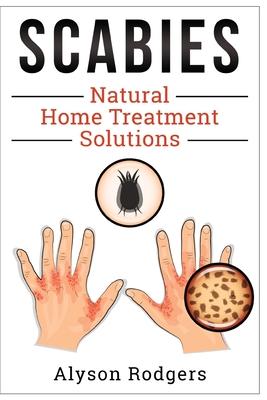 Scabies Natural Home Treatment Solution