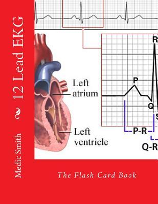 12 Lead EKG: The Flash Card Book