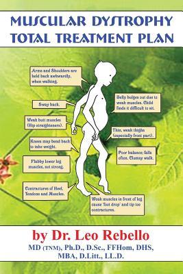 Muscular Dystrophy: Total Treatment Plan