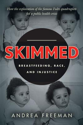 Skimmed: Breastfeeding, Race, and Injustice