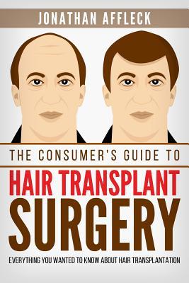 The Consumer's Guide to Hair Transplant Surgery: Everything You Wanted to Know About Hair Transplantation