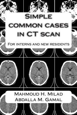 Simple common cases in CT scan: For interns and new residents