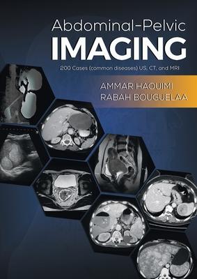 Abdominal-Pelvic Imaging