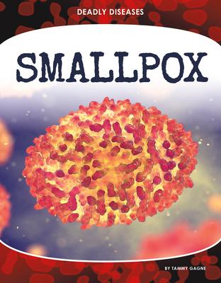 Smallpox