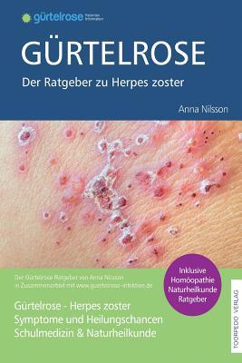 Grtelrose - Der groe Ratgeber zu Herpes zoster: Schulmedizin + Naturheilkunde