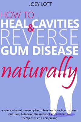 How to Heal Cavities and Reverse Gum Disease Naturally: a science-based, proven plan to heal teeth and gums using nutrition, balancing the metabolism,