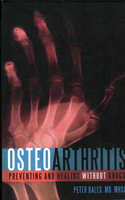 Osteoarthritis: Preventing and Healing Without Drugs