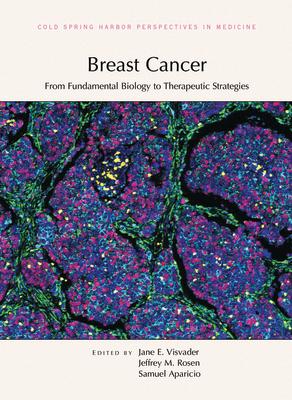 Breast Cancer: From Fundamental Biology to Therapeutic Strategies