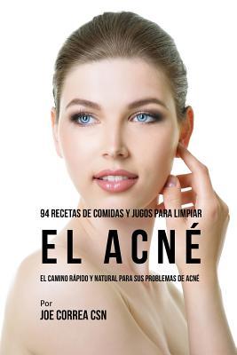 94 Recetas De Comidas Y Jugos Para Limpiar El Acn: El Camino Rpido Y Natural Para Sus Problemas de Acn Subscription