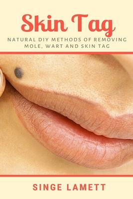 Skin Tag: Natural DIY Methods of removing Mole, Wart and Skin Tag Subscription