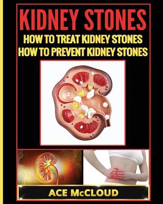 Kidney Stones: How To Treat Kidney Stones: How To Prevent Kidney Stones