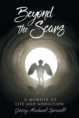 Beyond the Scars: A Memoir of Life and Addiction