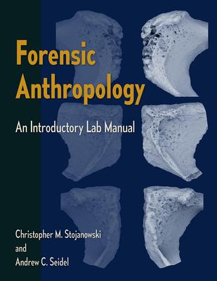 Forensic Anthropology: An Introductory Lab Manual