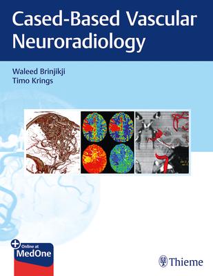Imaging in Neurovascular Disease: A Case-Based Approach Subscription