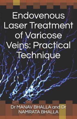 Endovenous Laser Treatment of Varicose Veins: Practical Technique