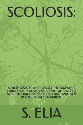 Scoliosis: : A Fresh Look at What Causes the Idiopathic Functional Scoliosis and Home Exercises to Stop the Progression of the Cu