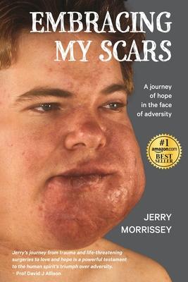 Embracing My Scars: A journey of hope in the face of adversity