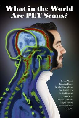 What in the World are PET Scans? Subscription