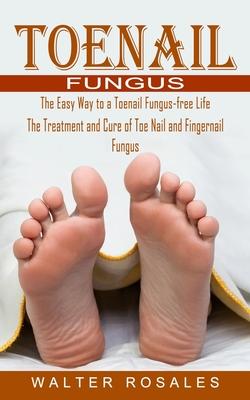 Toenail Fungus: The Easy Way to a Toenail Fungus-free Life (The Treatment and Cure of Toe Nail and Fingernail Fungus)