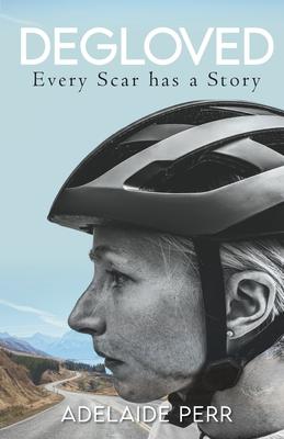 Degloved: Every Scar has a Story