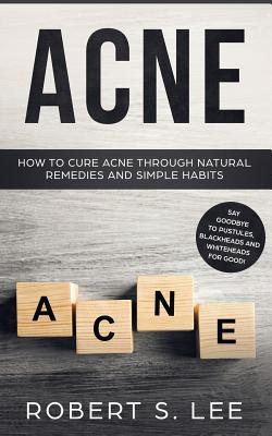 Acne: How to Cure Acne through Natural Remedies and Simple Habits. Say Goodbye to Pustules, Blackheads and Whiteheads for Good! Subscription