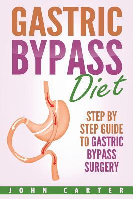 Gastric Bypass Diet: Step By Step Guide to Gastric Bypass Surgery