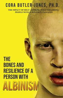 The Bones and Resilience of a Person with Albinism